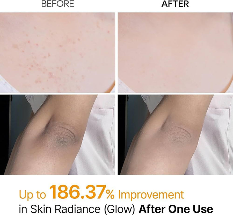 Dr.Melaxin Peel Shot Exfoliating Kojic Acid Turmeric Spray 200ml