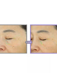 CENTELLIAN 24 PDRN Active Serum 50ml