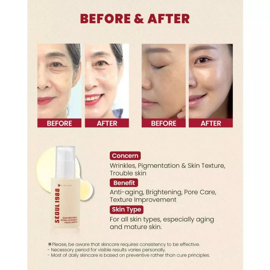 KSECRET SEOUL 1988 Serum: Retinal Liposome 2% + Black Ginseng 30ml